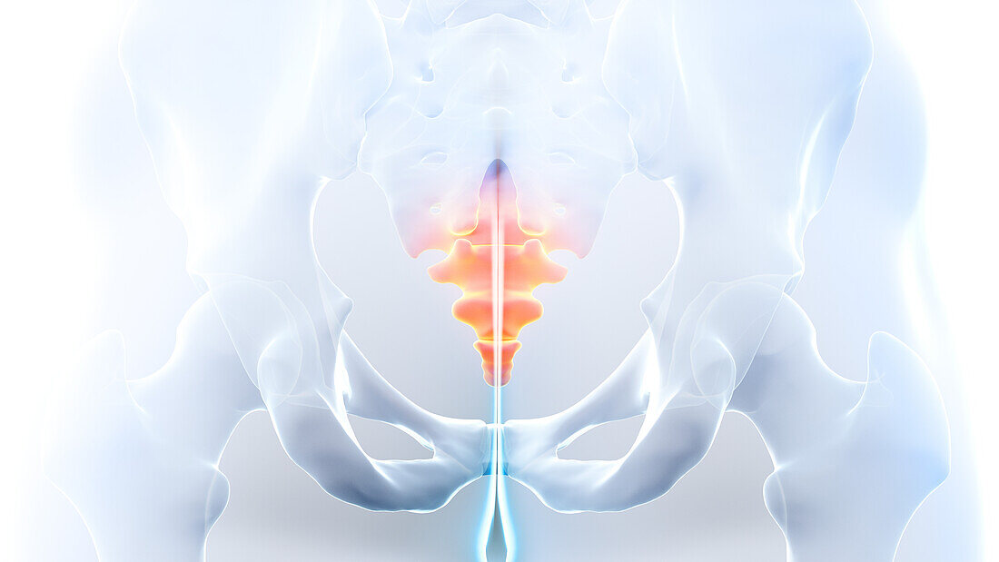 Painful coccyx, illustration