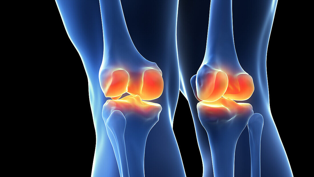 Painful knee joints, illustration