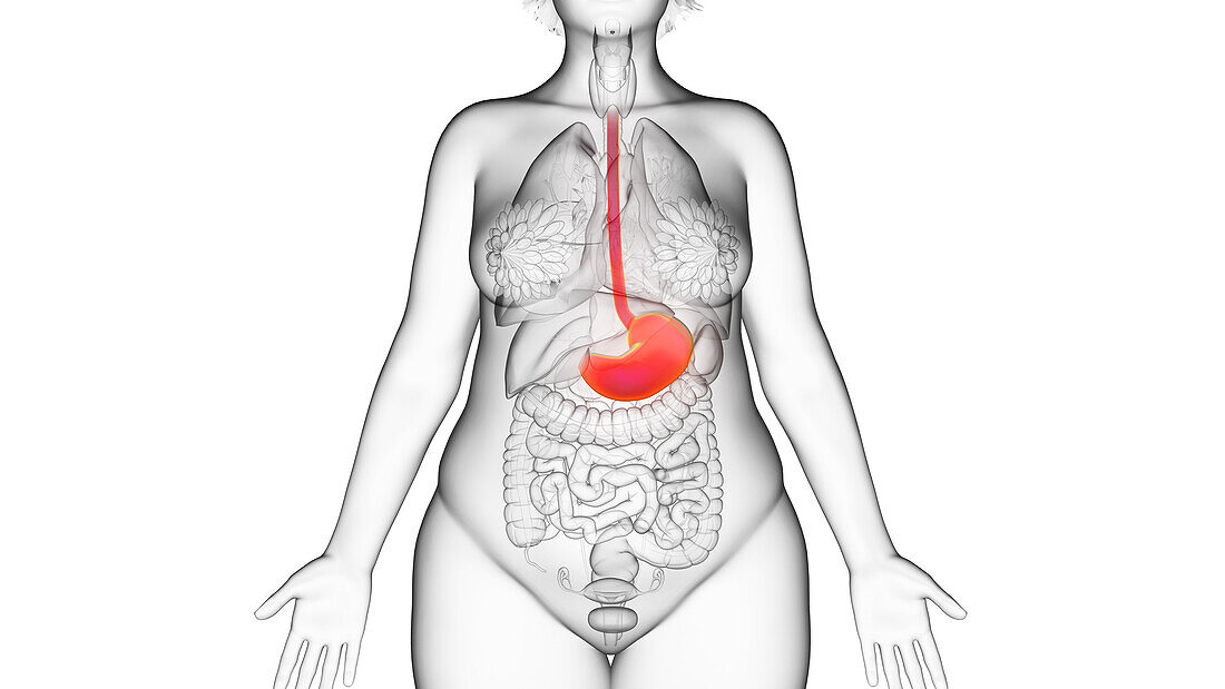 Obese woman's stomach, illustration