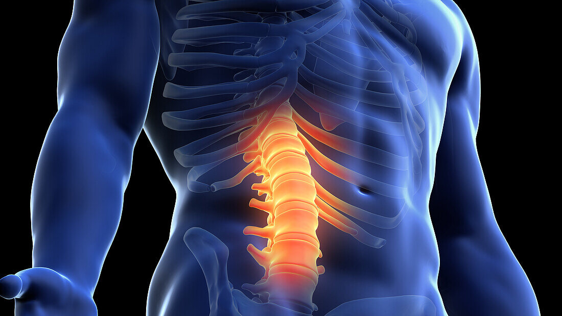 Painful spine, illustration