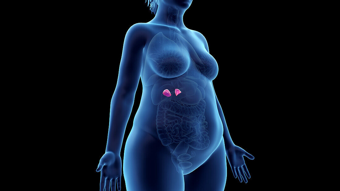 Obese woman's adrenal glands, illustration