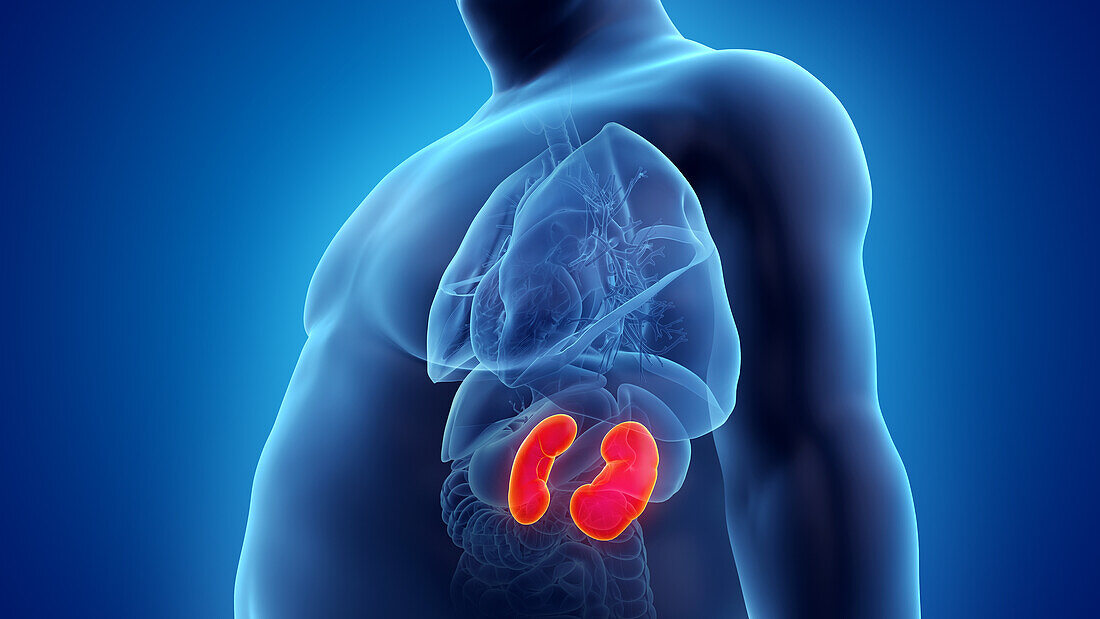 Obese man's kidneys, illustration