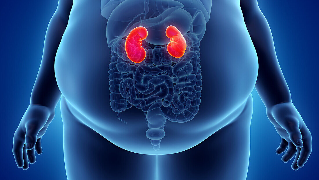 Obese man's kidneys, illustration