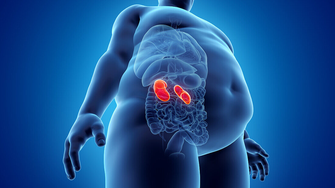 Obese man's kidneys, illustration