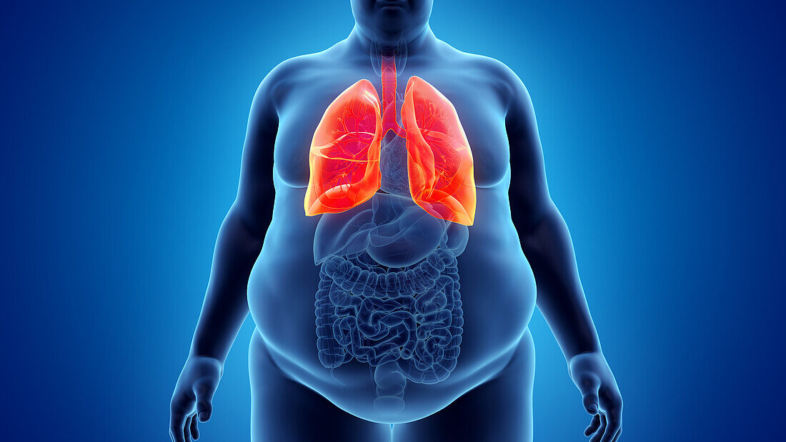 Obese man's lung, illustration