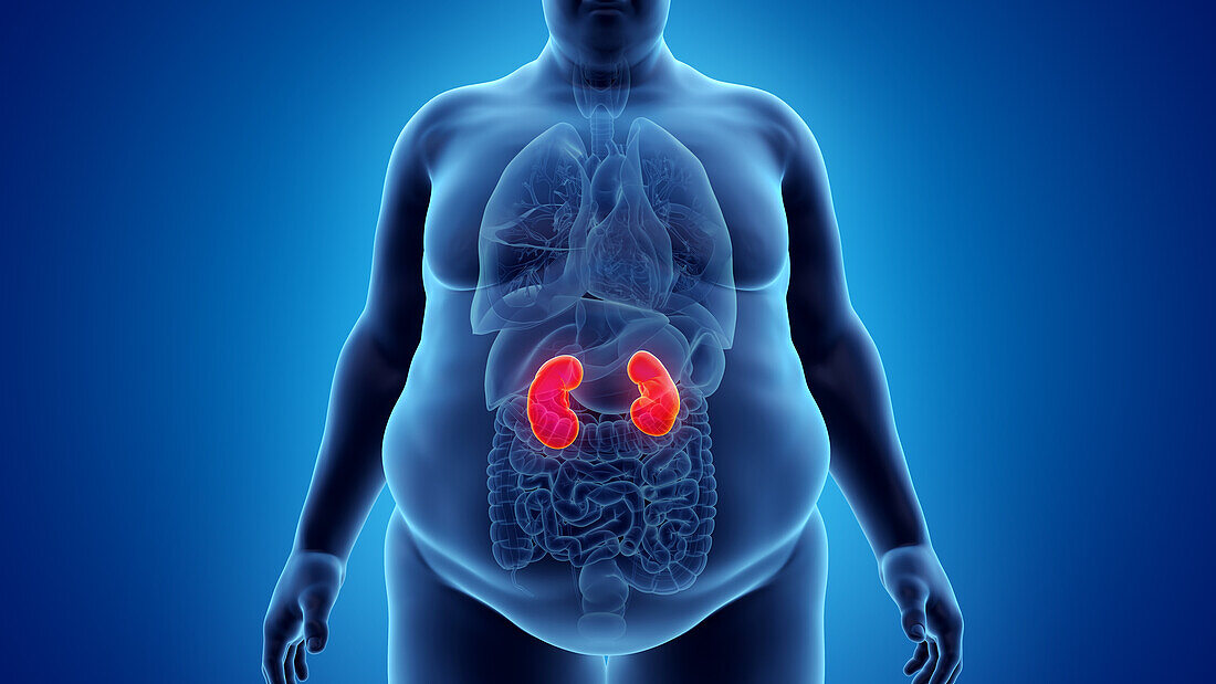 Obese man's kidneys, illustration