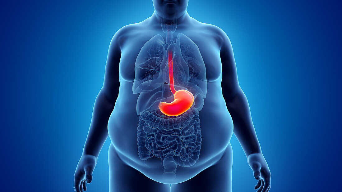 Obese man's stomach, illustration