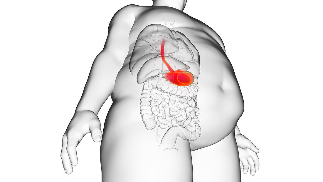 Obese man's stomach, illustration