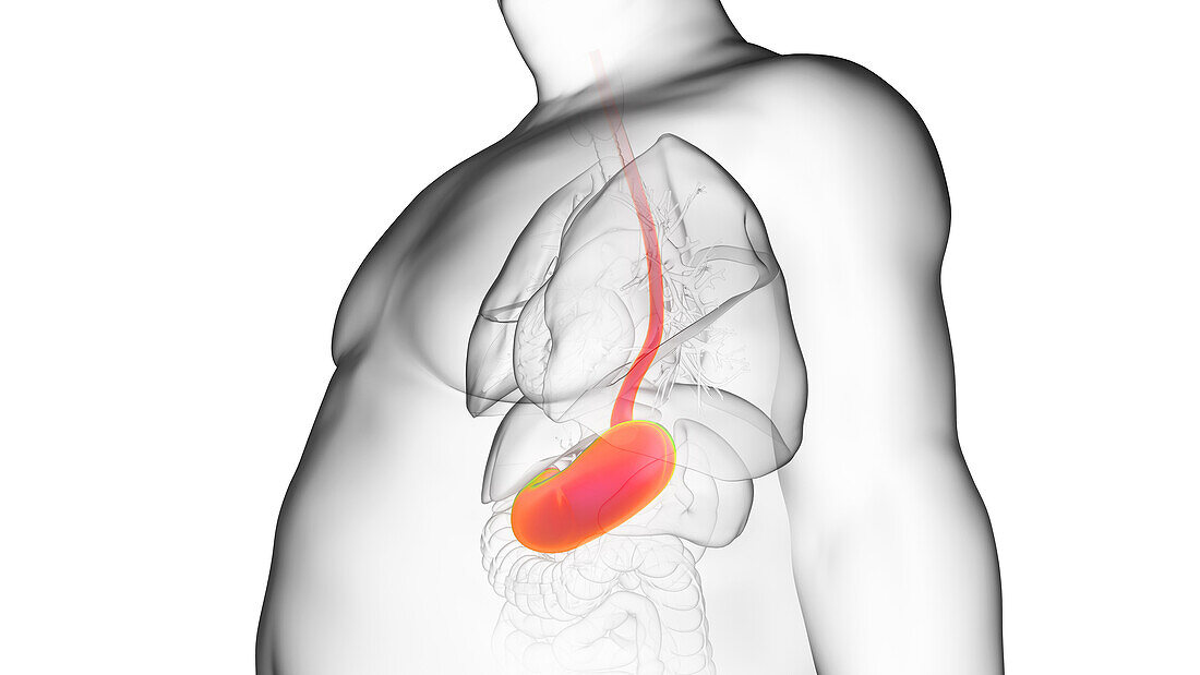 Obese man's stomach, illustration