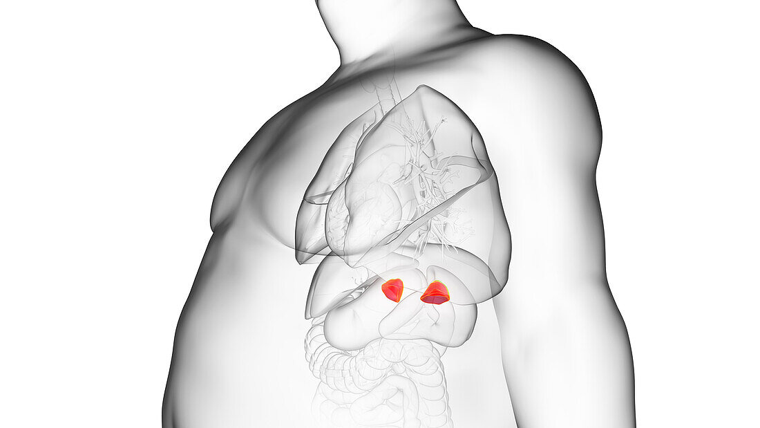 Obese man's adrenal glands, illustration