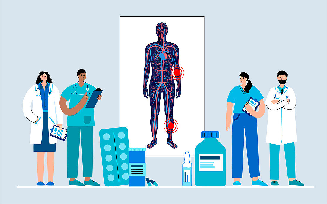 Peripheral artery disease, illustration