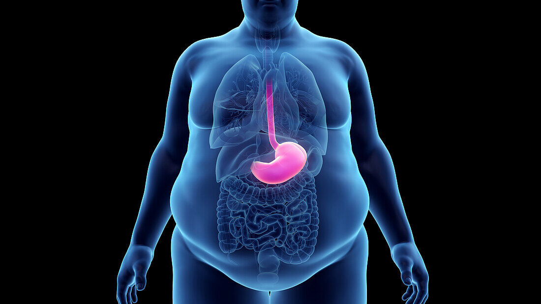 Obese man's stomach, illustration