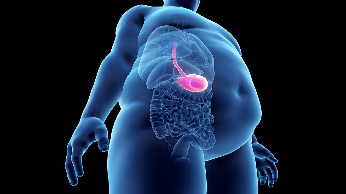 Obese man's stomach, illustration