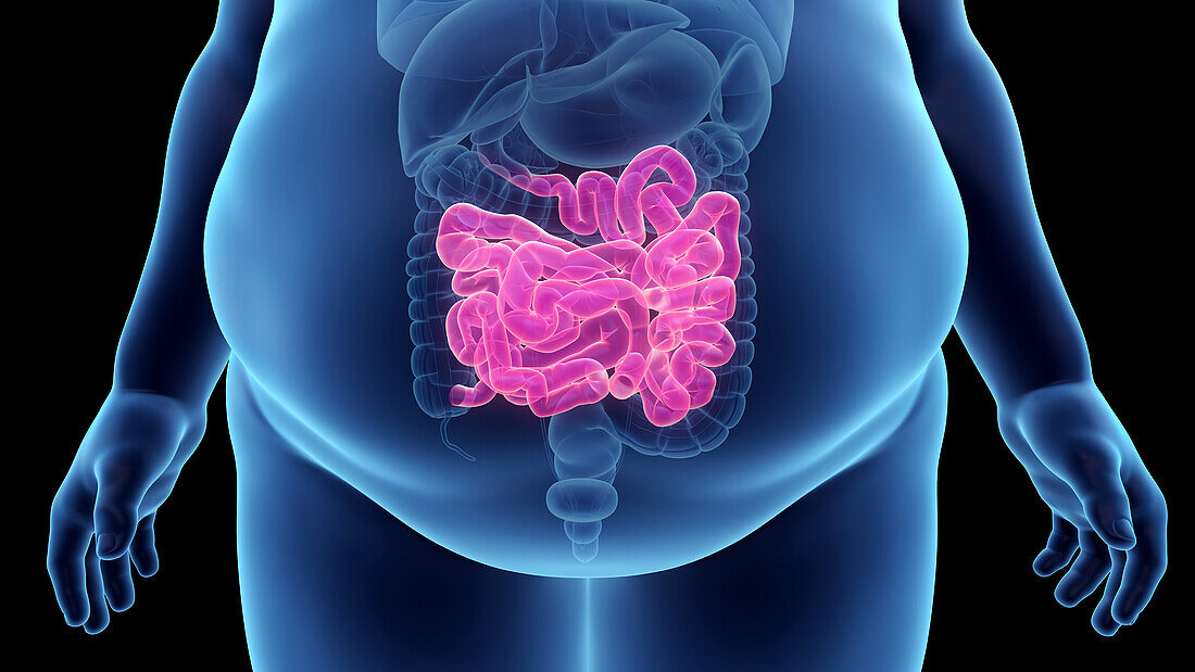 Obese man's small intestine, illustration