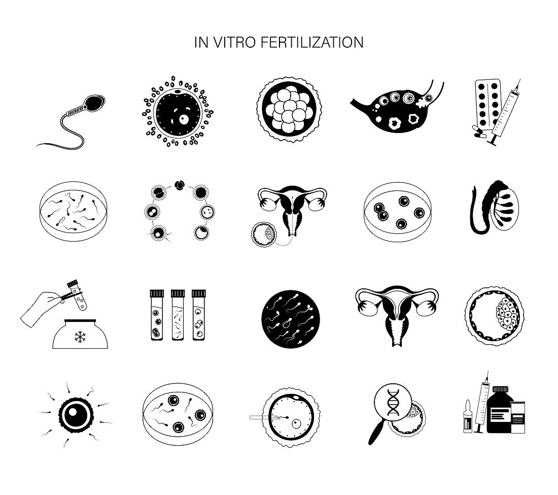 IVF, illustration