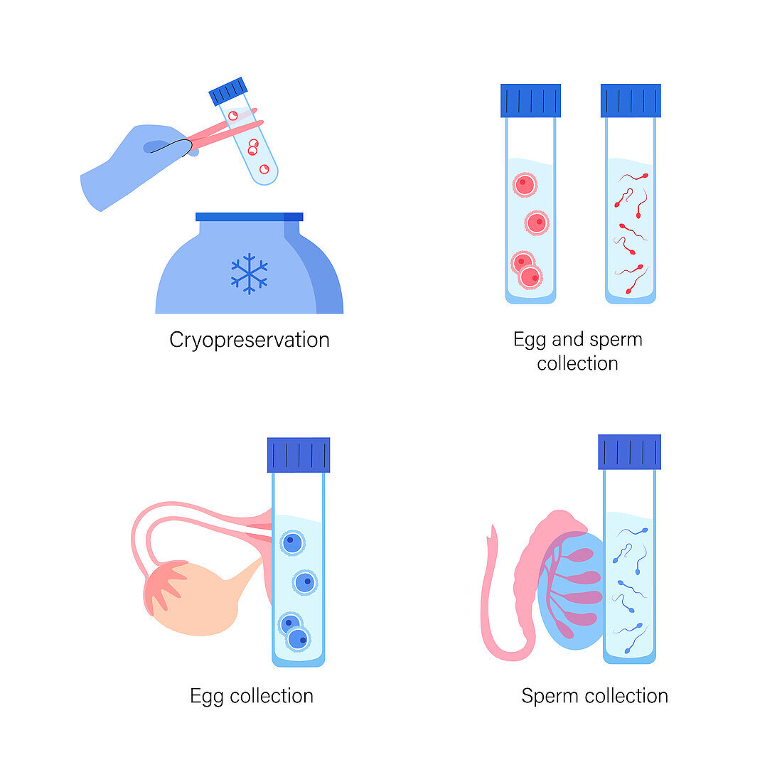IVF specimen collection and cryopreservation, illustration