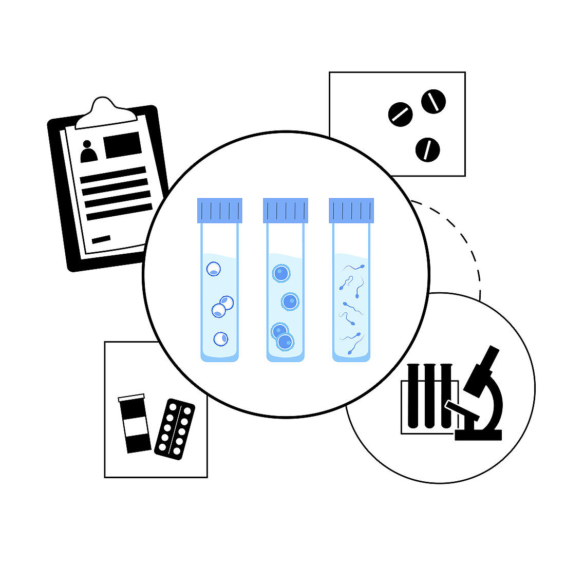 IVF specimen collection, conceptual illustration