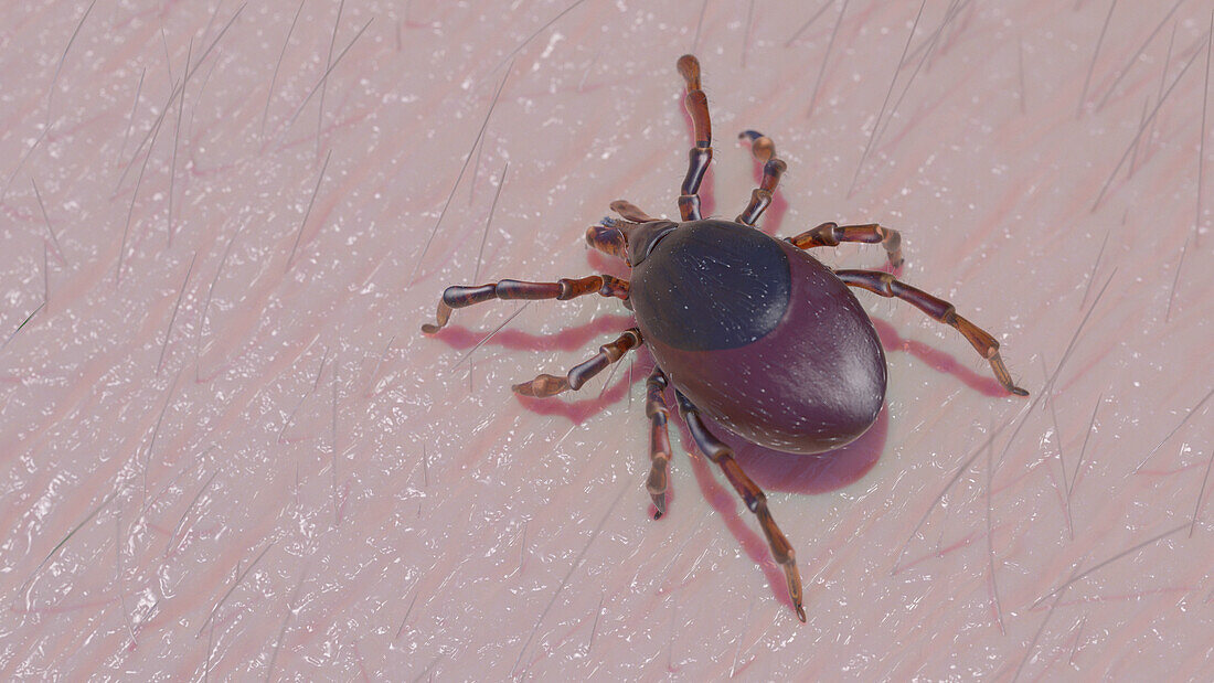 Tick on human skin, illustration