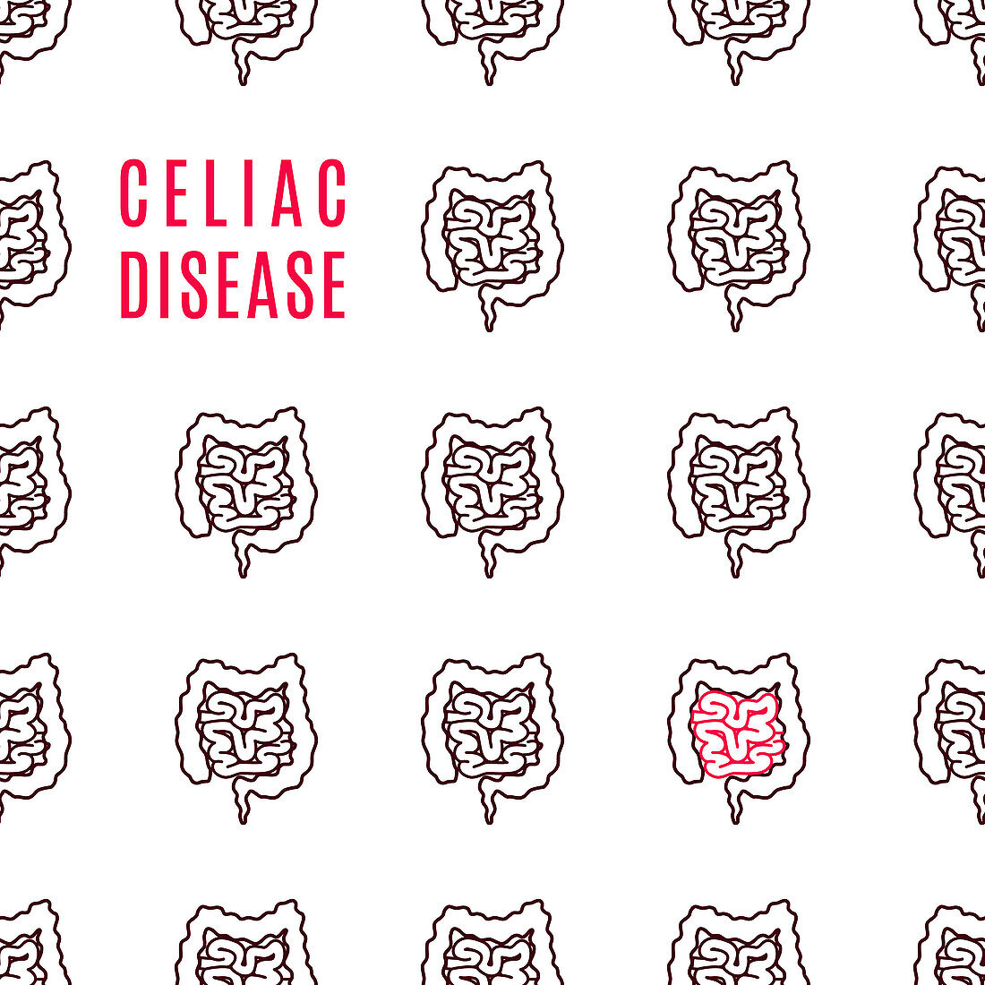 Celiac disease, conceptual illustration