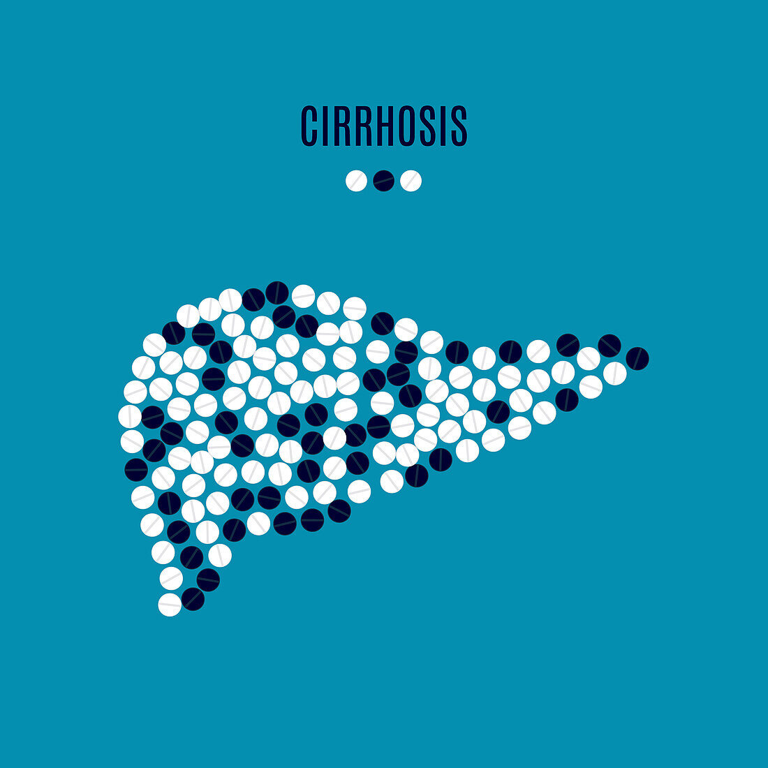 Cirrhosis, conceptual illustration