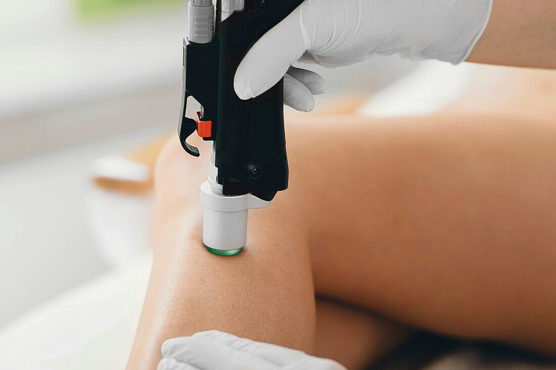 Leg laser hair removal