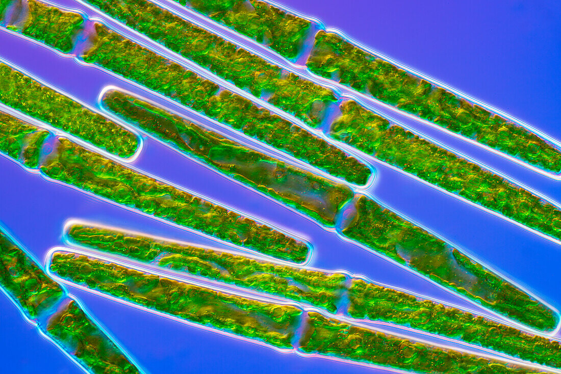 Haplotaenium rectum, algae, light micrograph