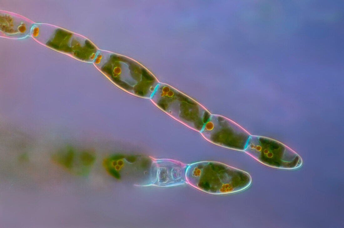 Trentepohlia sp, algae, light micrograph