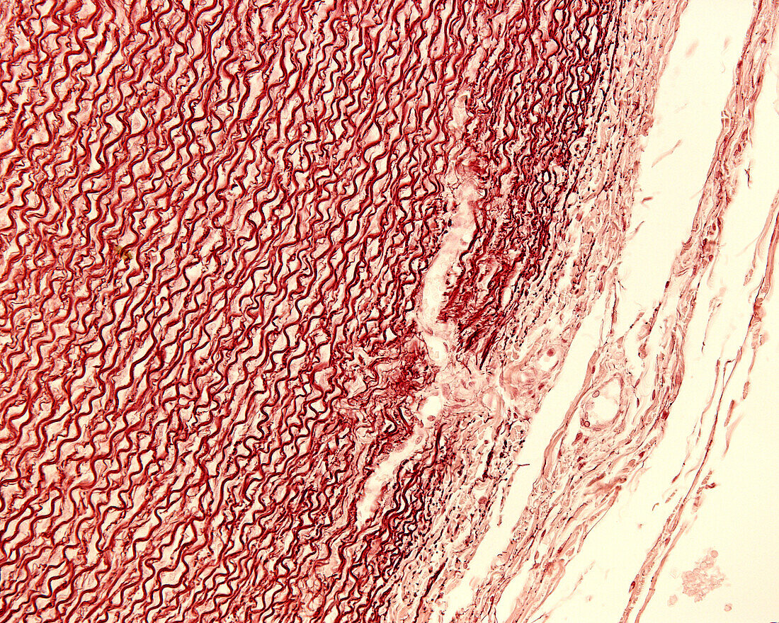 Human aorta, light micrograph