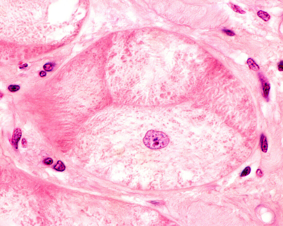 Heart. Purkinje fibre, light micrograph