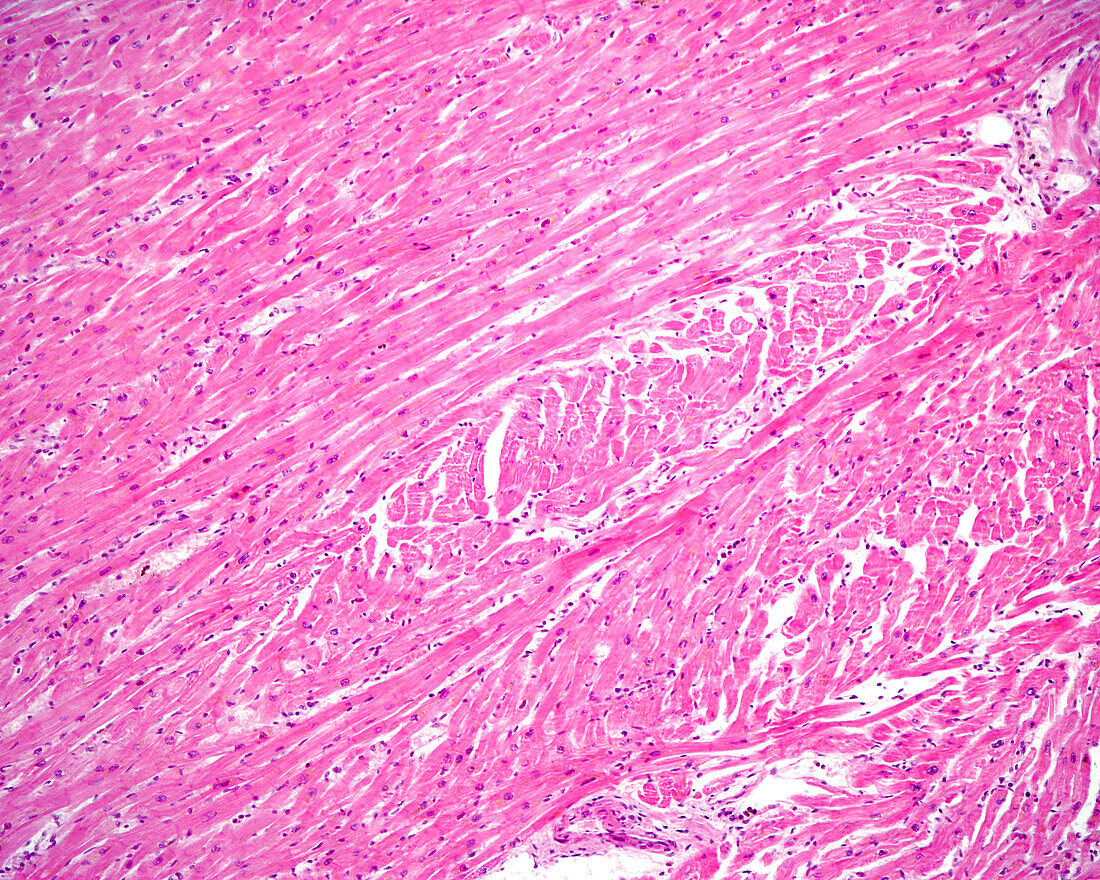 Heart myocardium, light micrograph