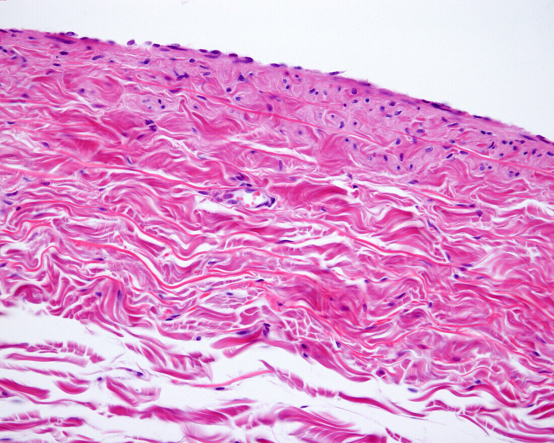 Large vein wall, light micrograph