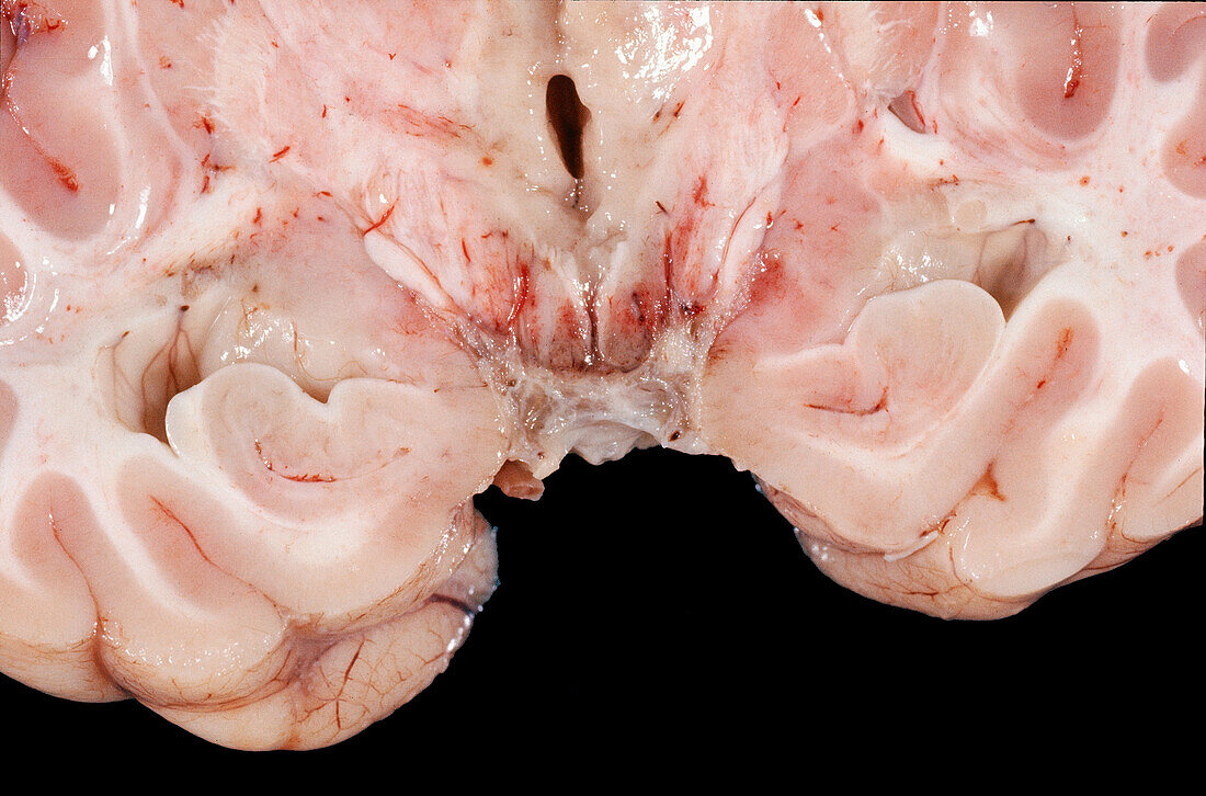 Human brain, gross specimen