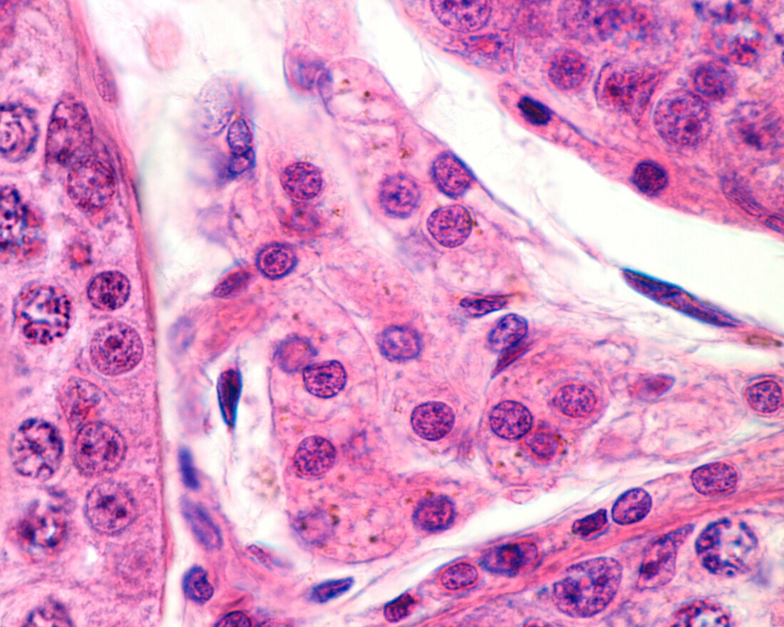 Spermatogenesis in human testicle, light micrograph