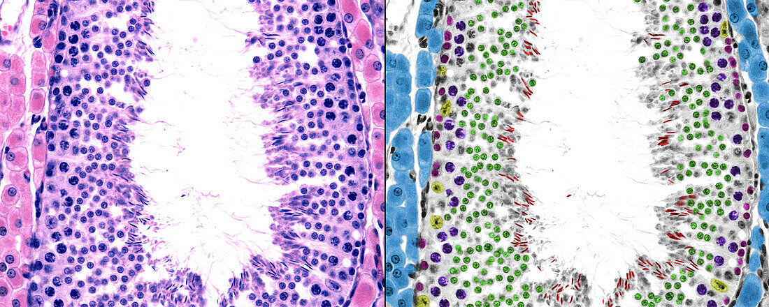 Seminiferous tubules and Leydig cells, light micrographs
