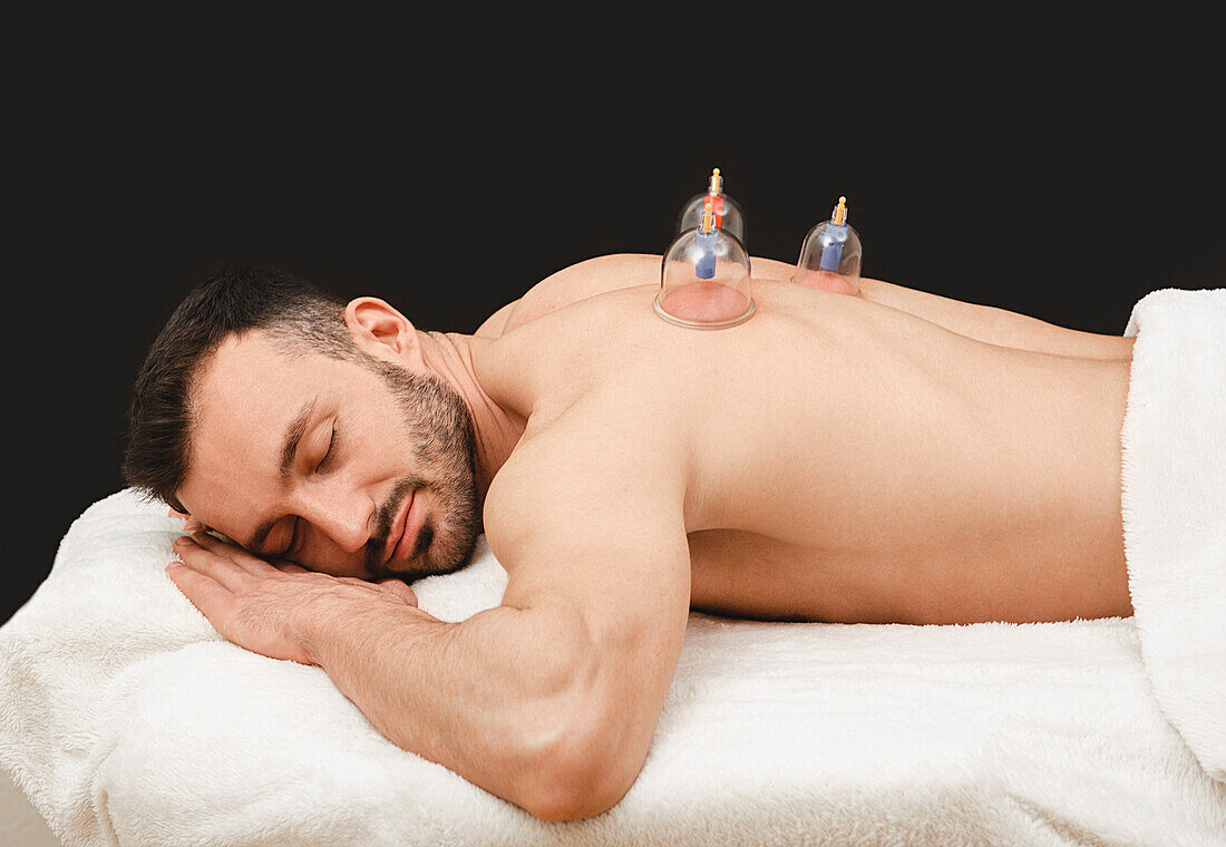 Cupping therapy