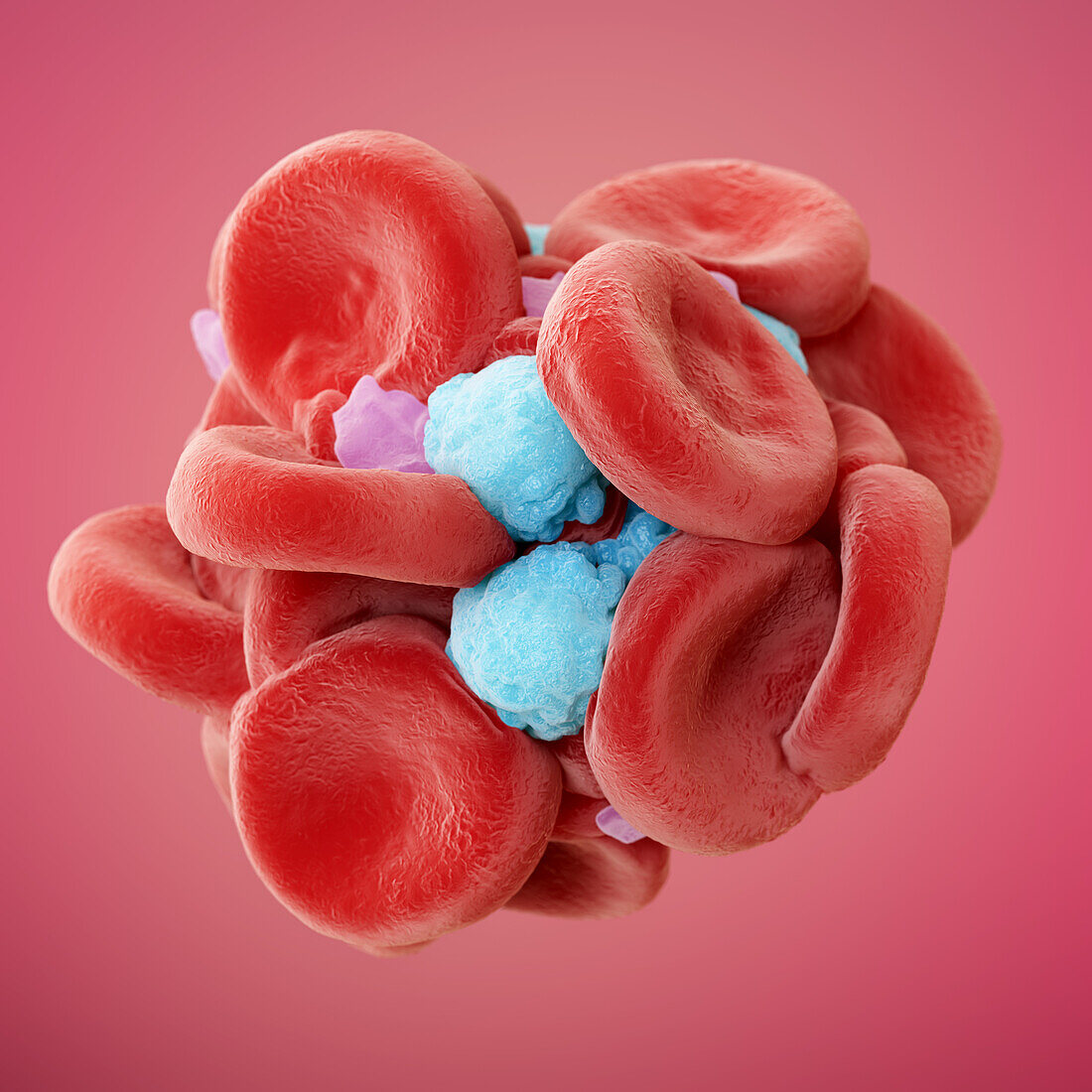 Blood clot, illustration