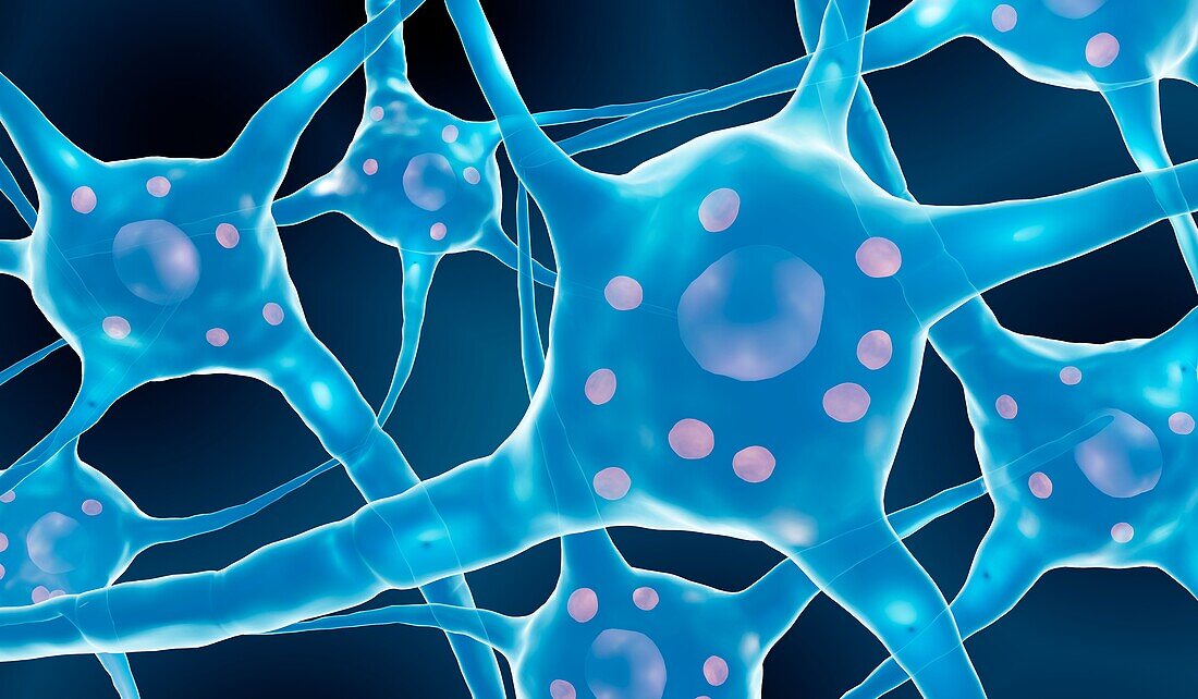Parkinson's disease neurons, illustration