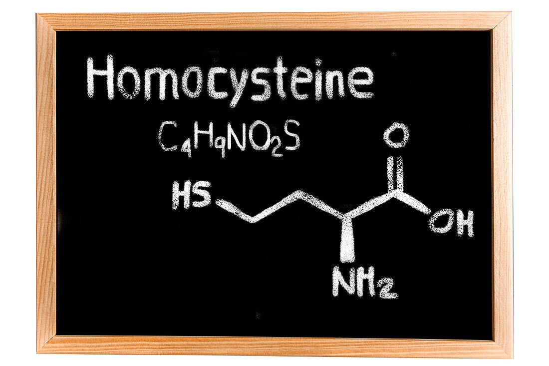 Chemical composition of homocysteine, conceptual image