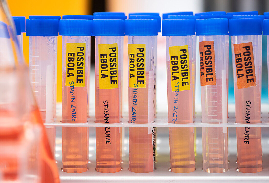 Blood samples from patients with Zaire strain of Ebola