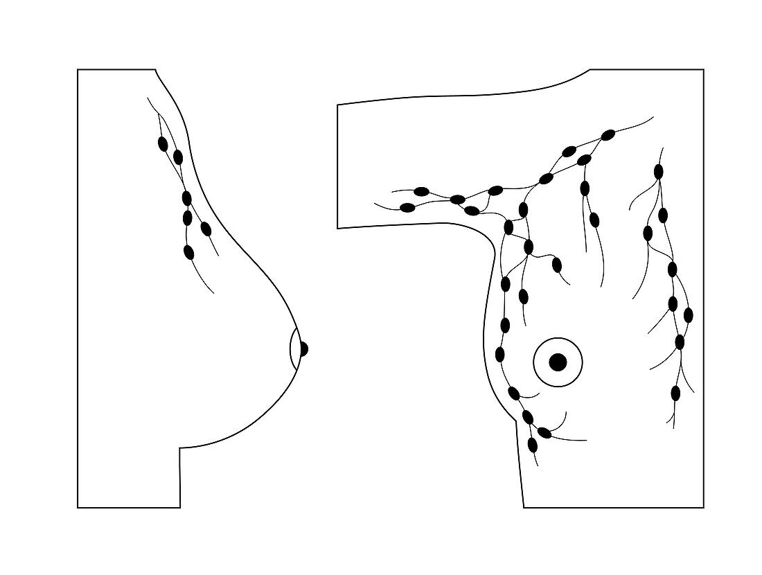 Female chest lymph nodes, illustration