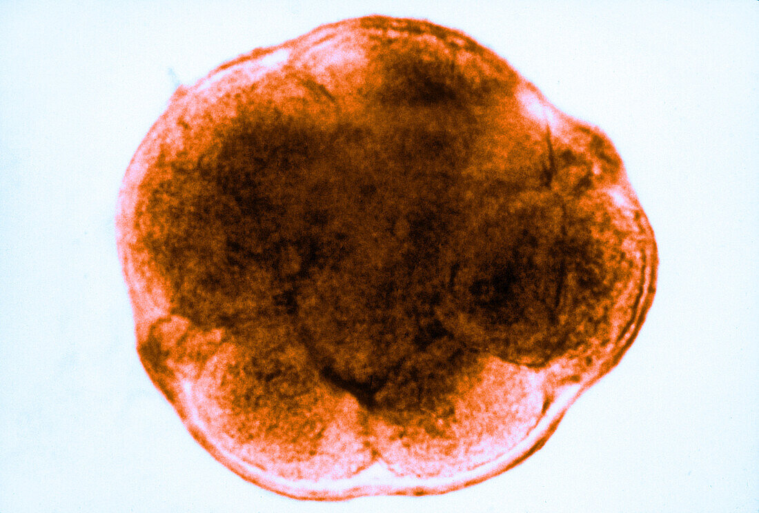Human embryo at 8-Cell Stage, light micrograph