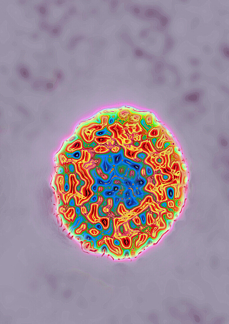 Hepatitis C virus, TEM