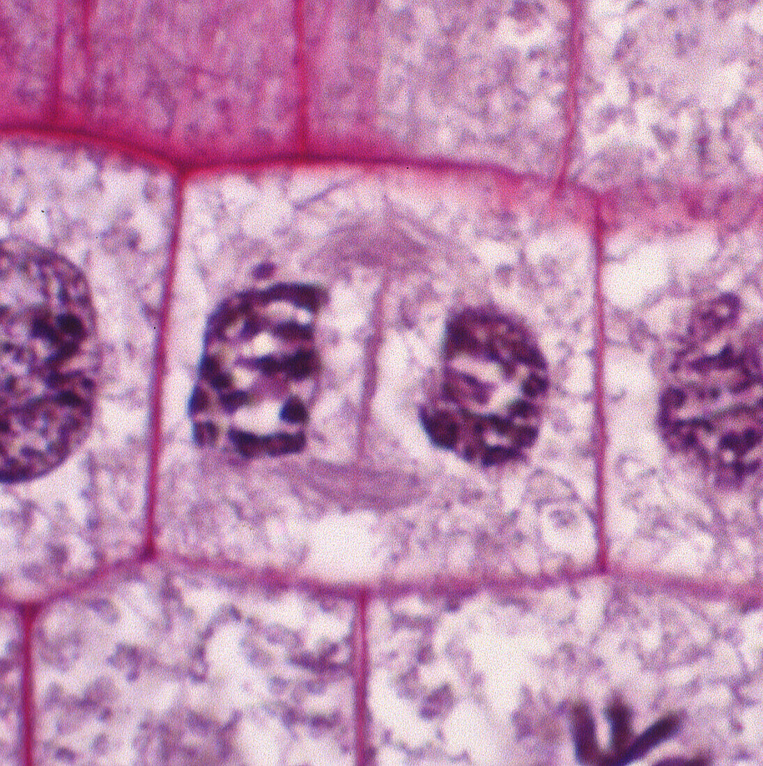 Cytokinesis in onion root tip cell, light micrograph