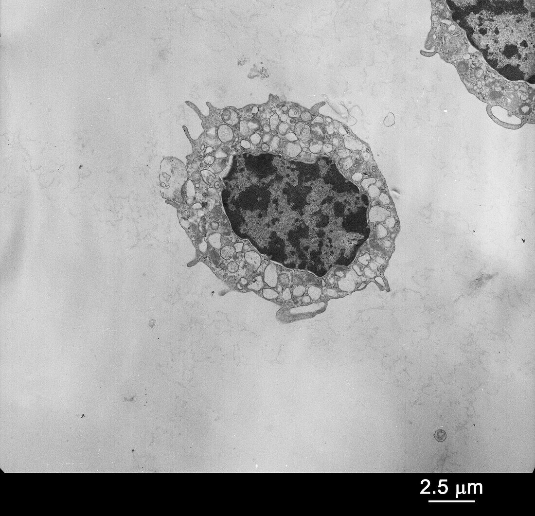 Mast cell (mouse), TEM