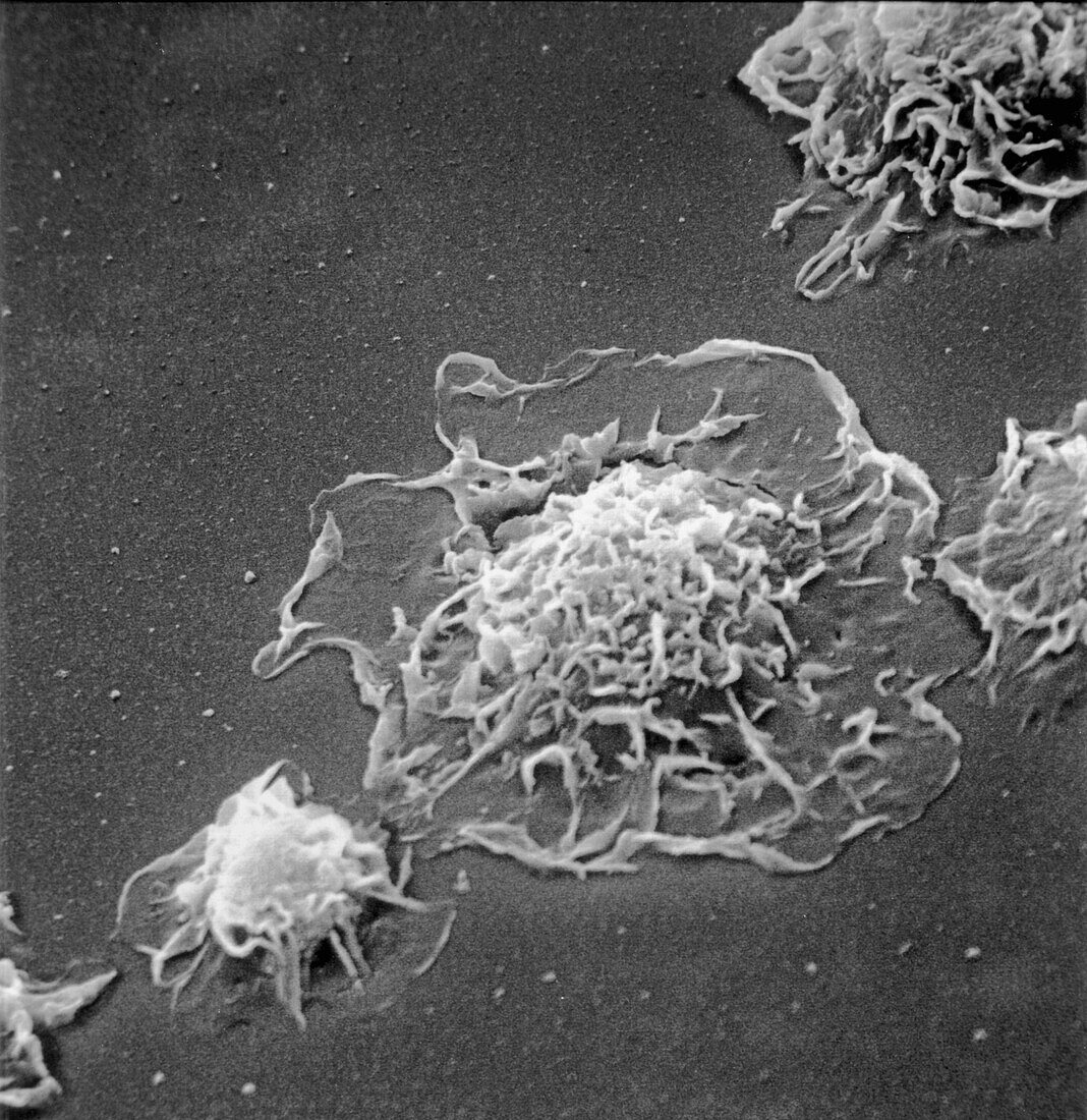 Macrophage, SEM