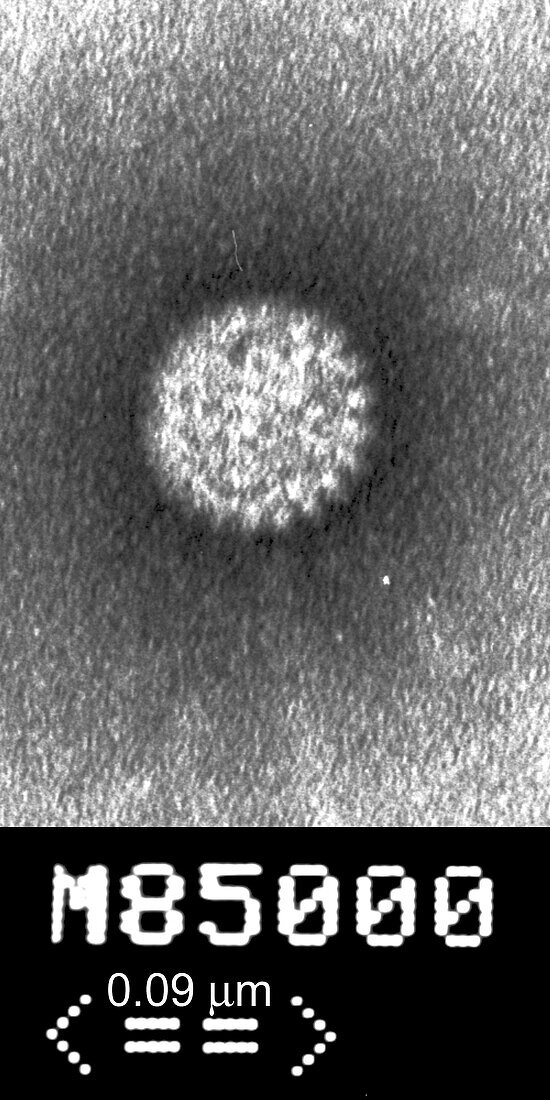 Human rotavirus, TEM