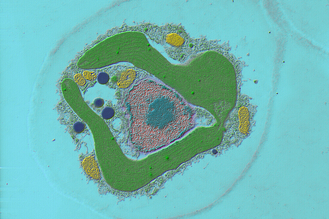 Freshwater algae (Dinobryon sp.), TEM