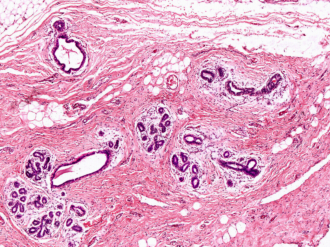 Inactive human mammary gland, light micrograph
