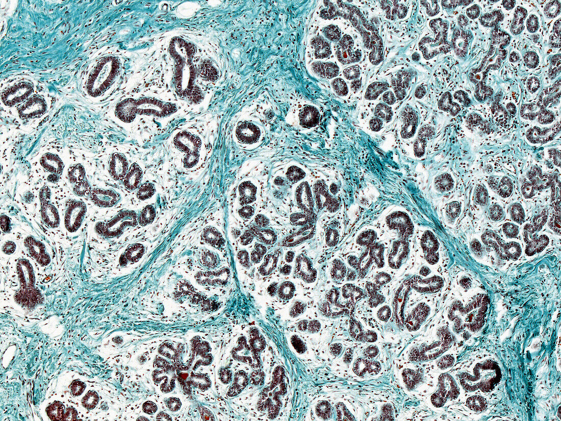 Human mammary gland in pregnancy, light micrograph