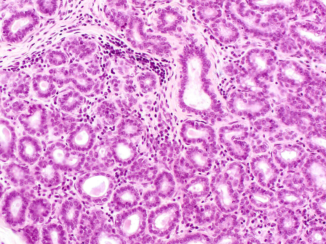 Human mammary gland in pregnancy, light micrograph